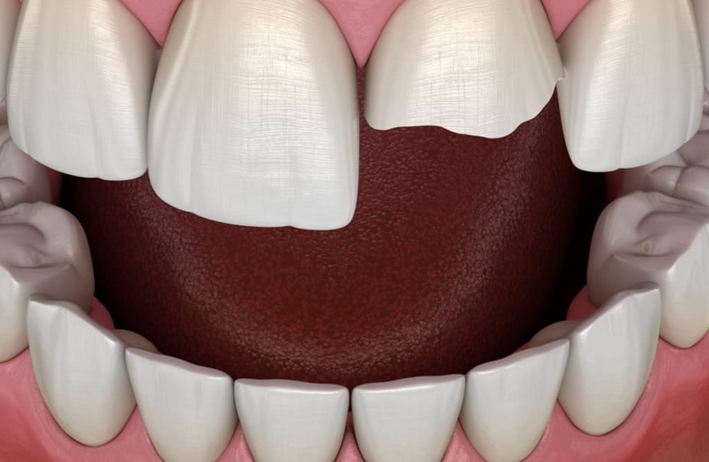 We’re Handling Dental Emergencies